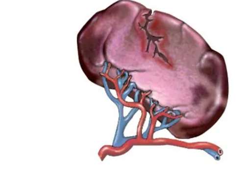 Splenic Disorders